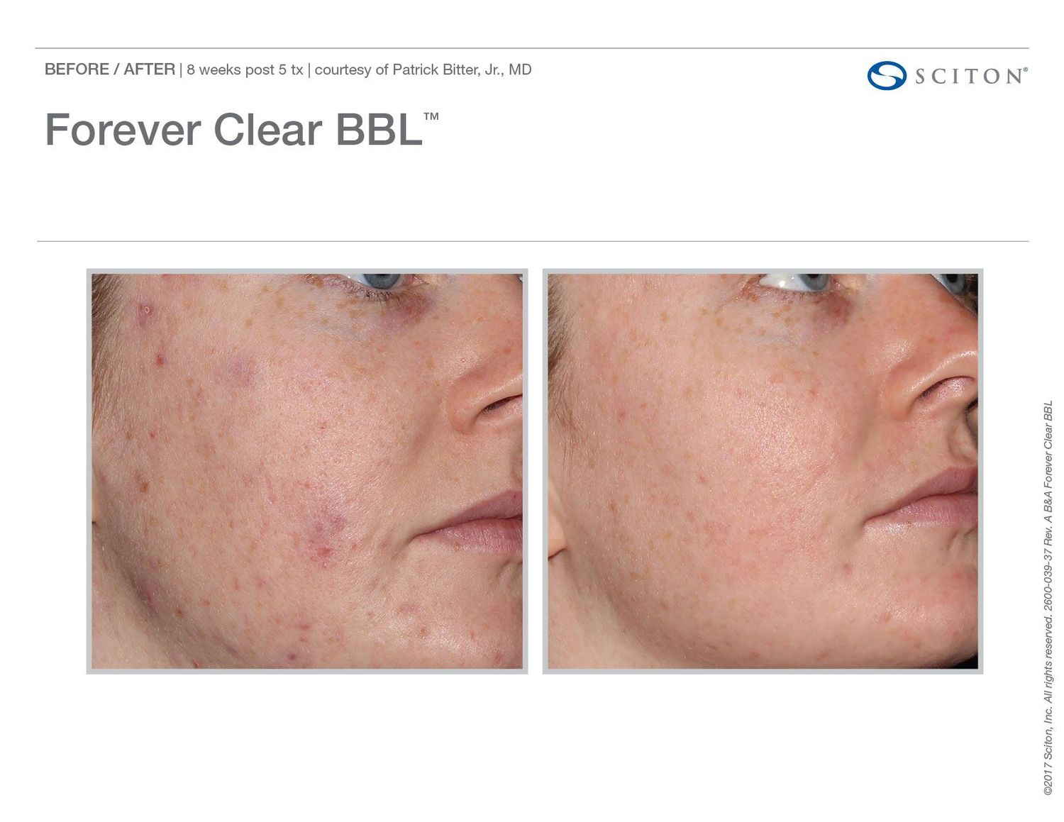 Smiling woman with short blonde hair outdoors.