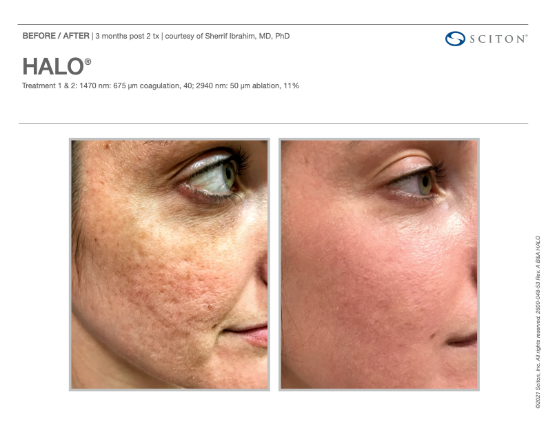 Smiling woman with freckles and curly hair.